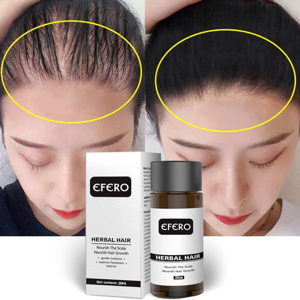 2019 Natural Ginger Hair Loss Essence Oil  Effective Dense Hair Growth Essential Liquid 20ml Prevent Baldness Care Serum TSLM2