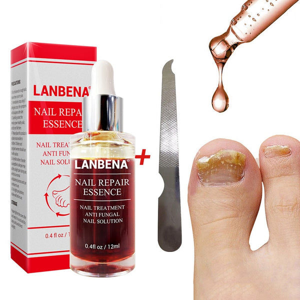 New 12ml Nail Fungal Treatment With File Anti Fungus Onychomycosis Removal Nails Care Repair Liquid 998