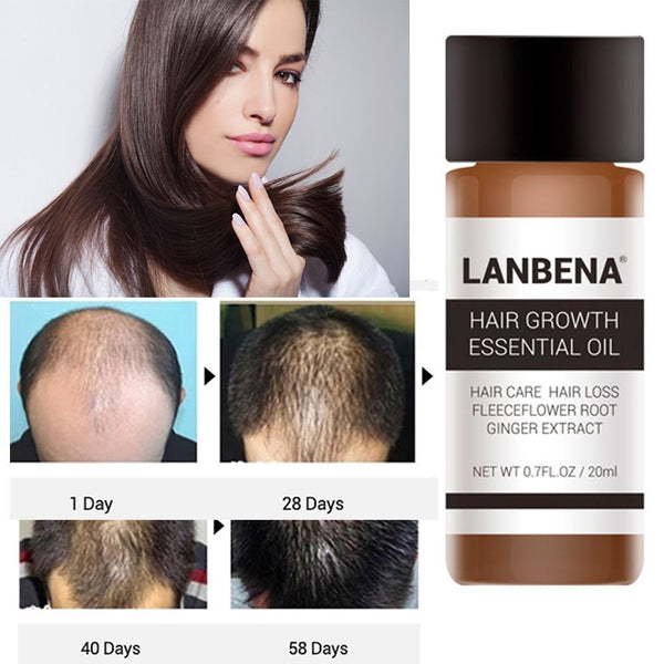 LANBENA 30ML Powerful Hair Growth Essential Oil Treatment Anti Hair Loss Hair Care Repair Hurt Hair Hair Care Products TSLM2